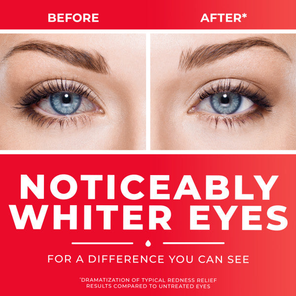 Clear Eyes Redness Eye Relief Lubricant Eye Drops, 1.0 fl oz